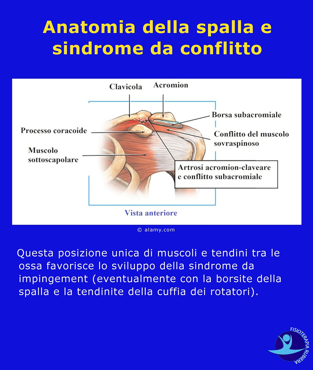 Anatomia della spalla e sindrome da conflitto