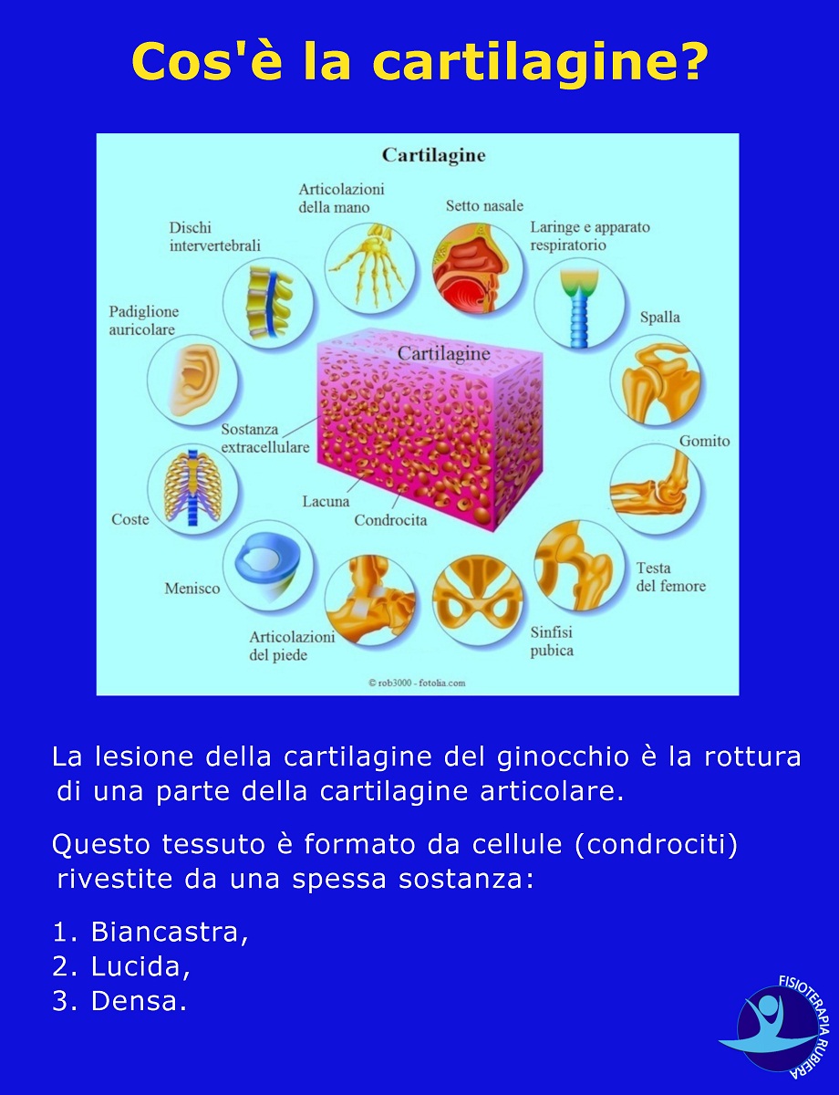 Cos'è-la-cartilagine