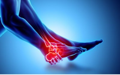 Distorsione alla Caviglia: i Sintomi, la Fisioterapia e gli Esercizi