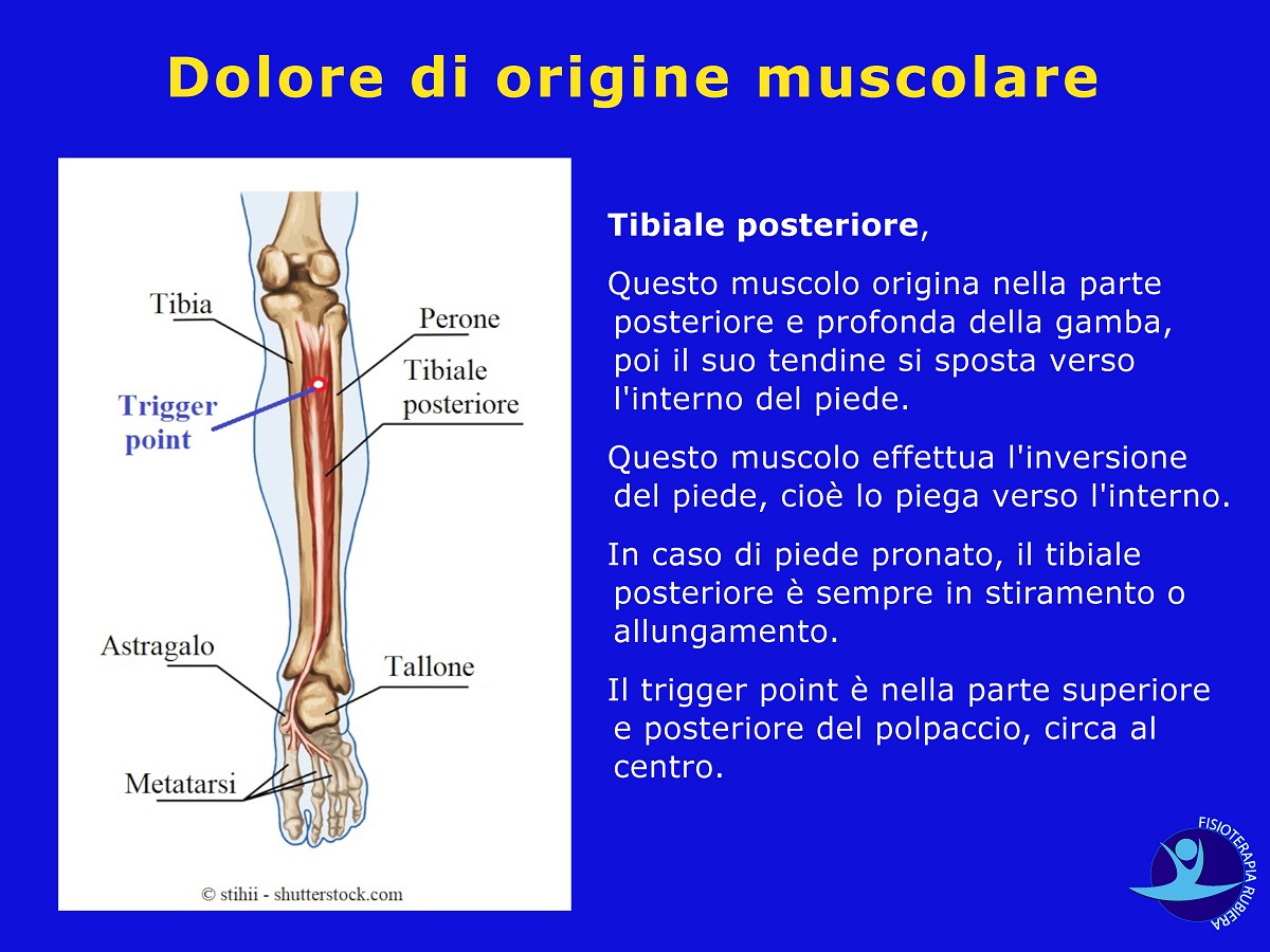 trigger point tibiale posteriore