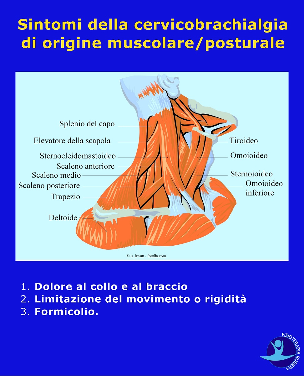 Sintomi-della-cervicobrachialgia-di-origine-muscolare-posturale