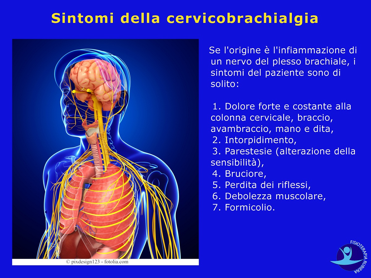 Sintomi-della-cervicobrachialgia