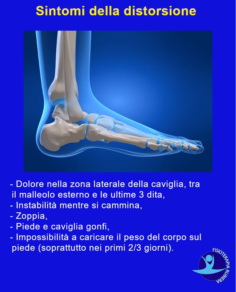 sintomi-distorsione-caviglia