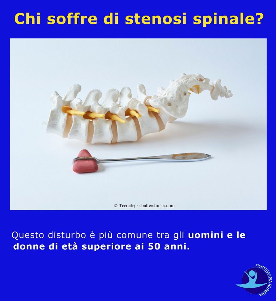Chi-soffre-di-stenosi-spinale