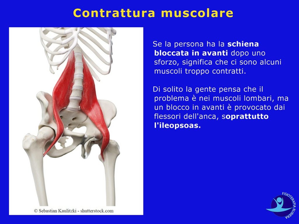Contrattura-muscolare