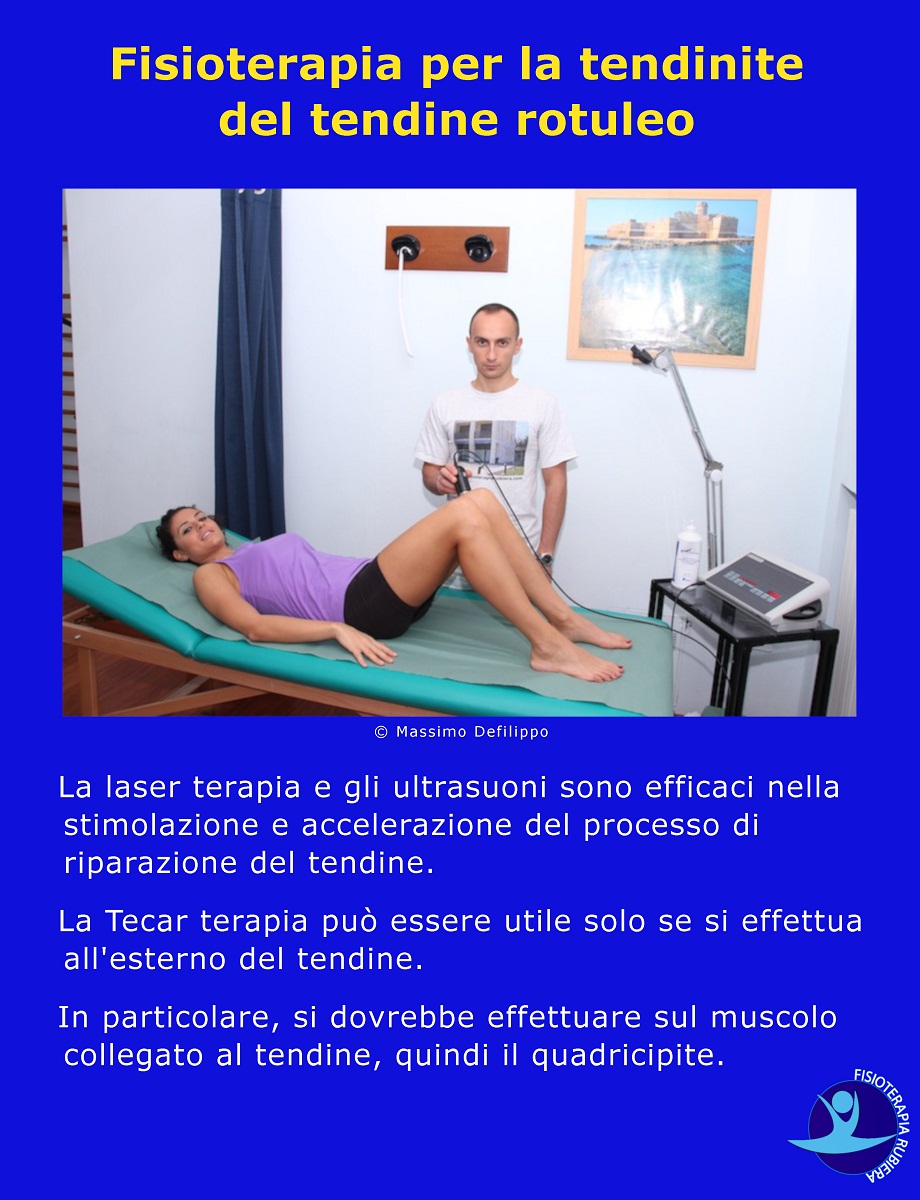 Fisioterapia-per-la-tendinite-del-tendine-rotuleo