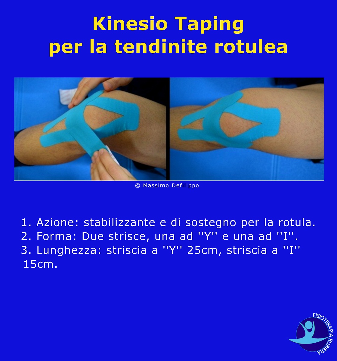 Kinesio-Taping-per-la-tendinite-rotulea