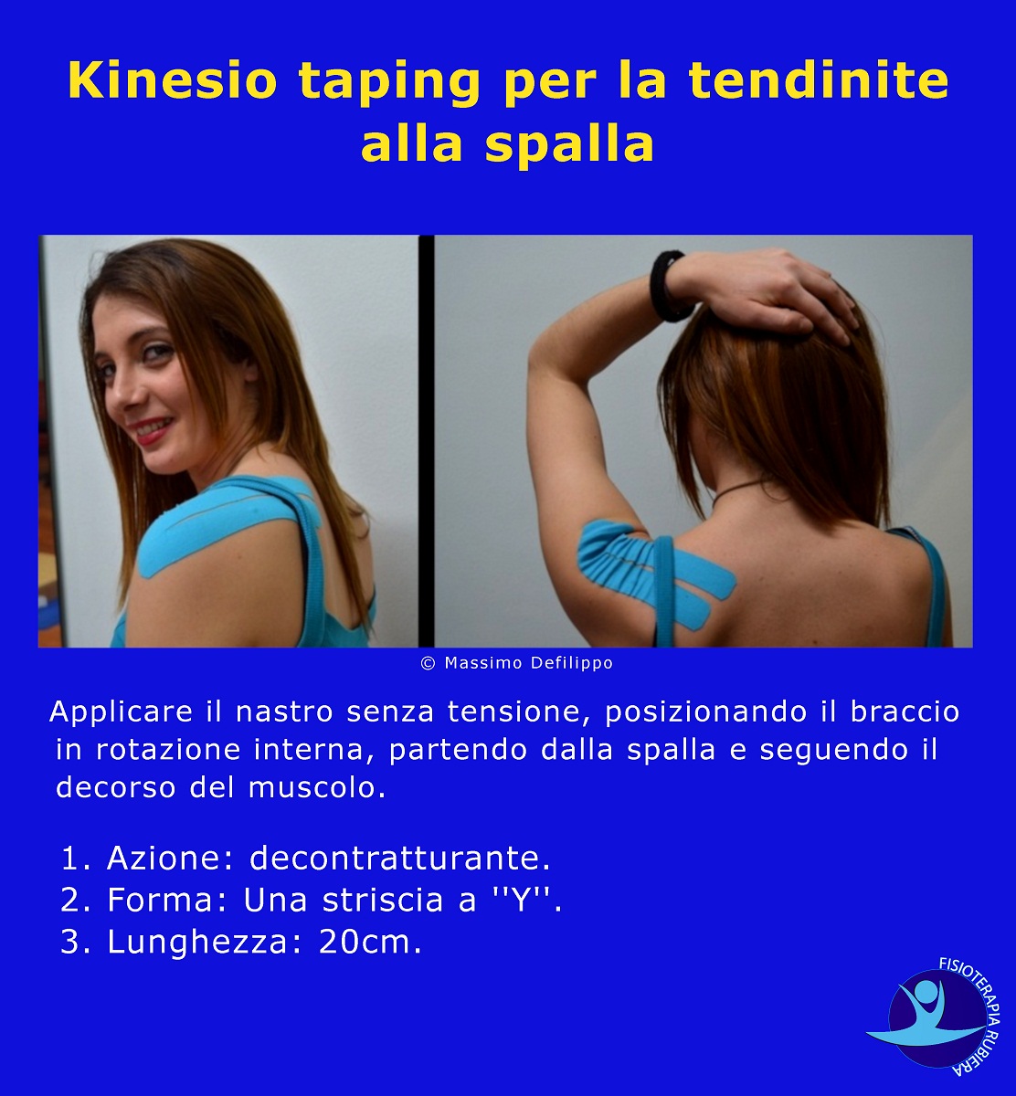 Kinesio taping per la tendinite alla spalla