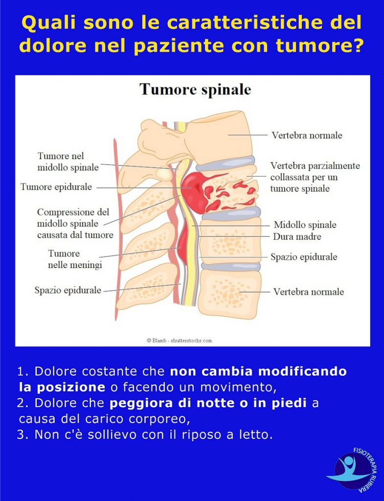 caratteristiche-del-dolore-nel-paziente-con-tumore