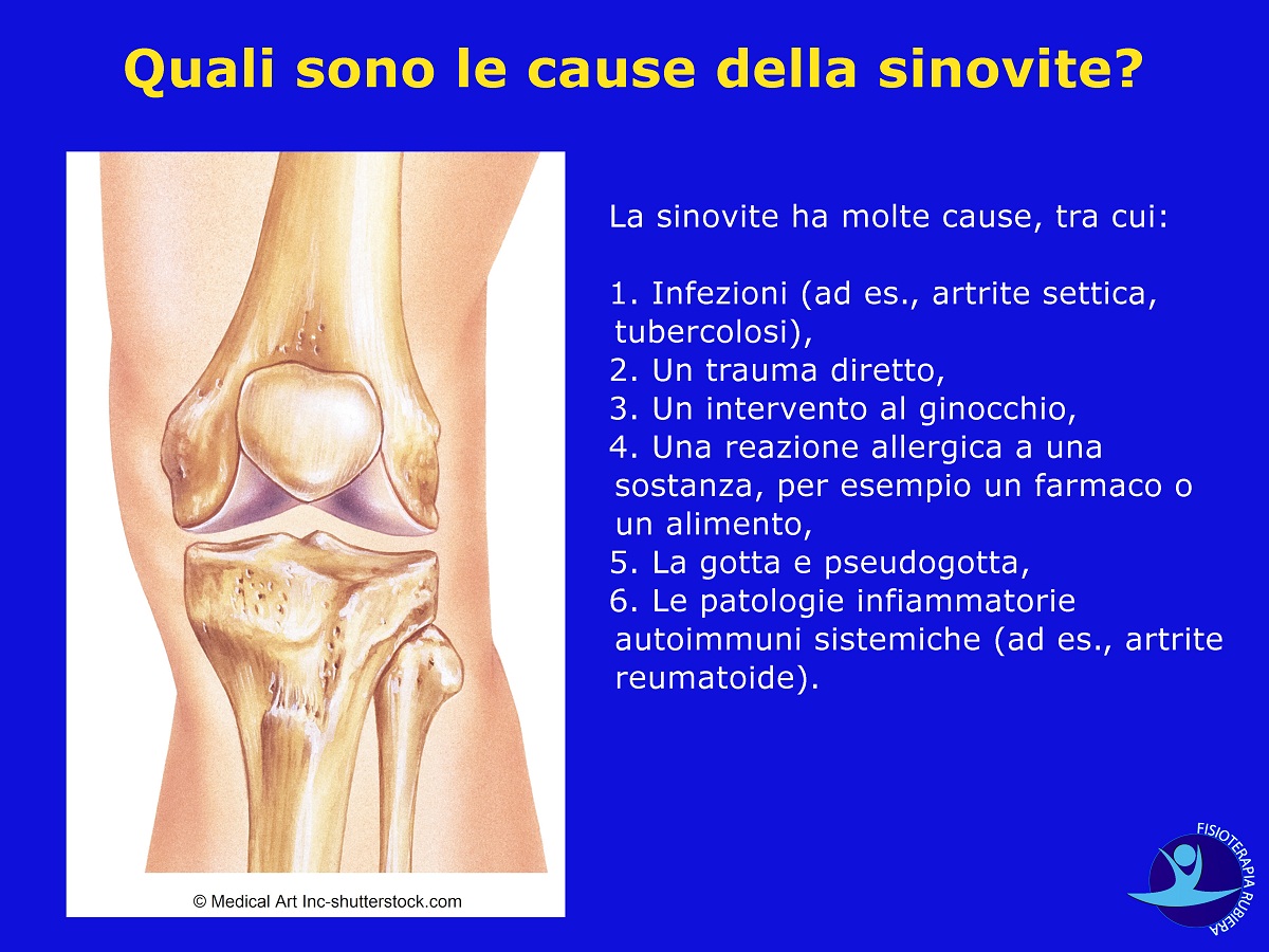artrite settica: sintomi