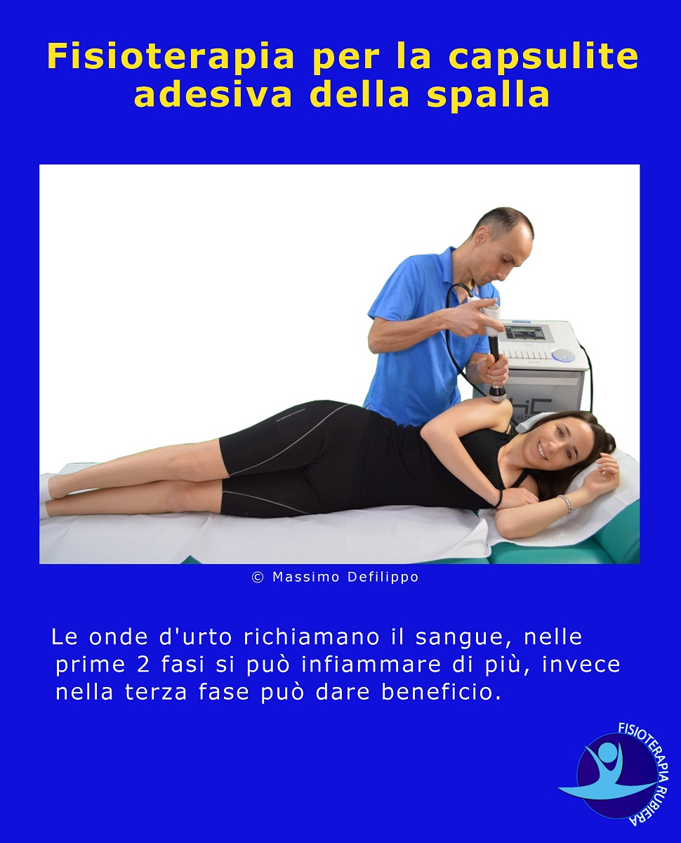 Fisioterapia-per-la-capsulite-adesiva-della-spalla