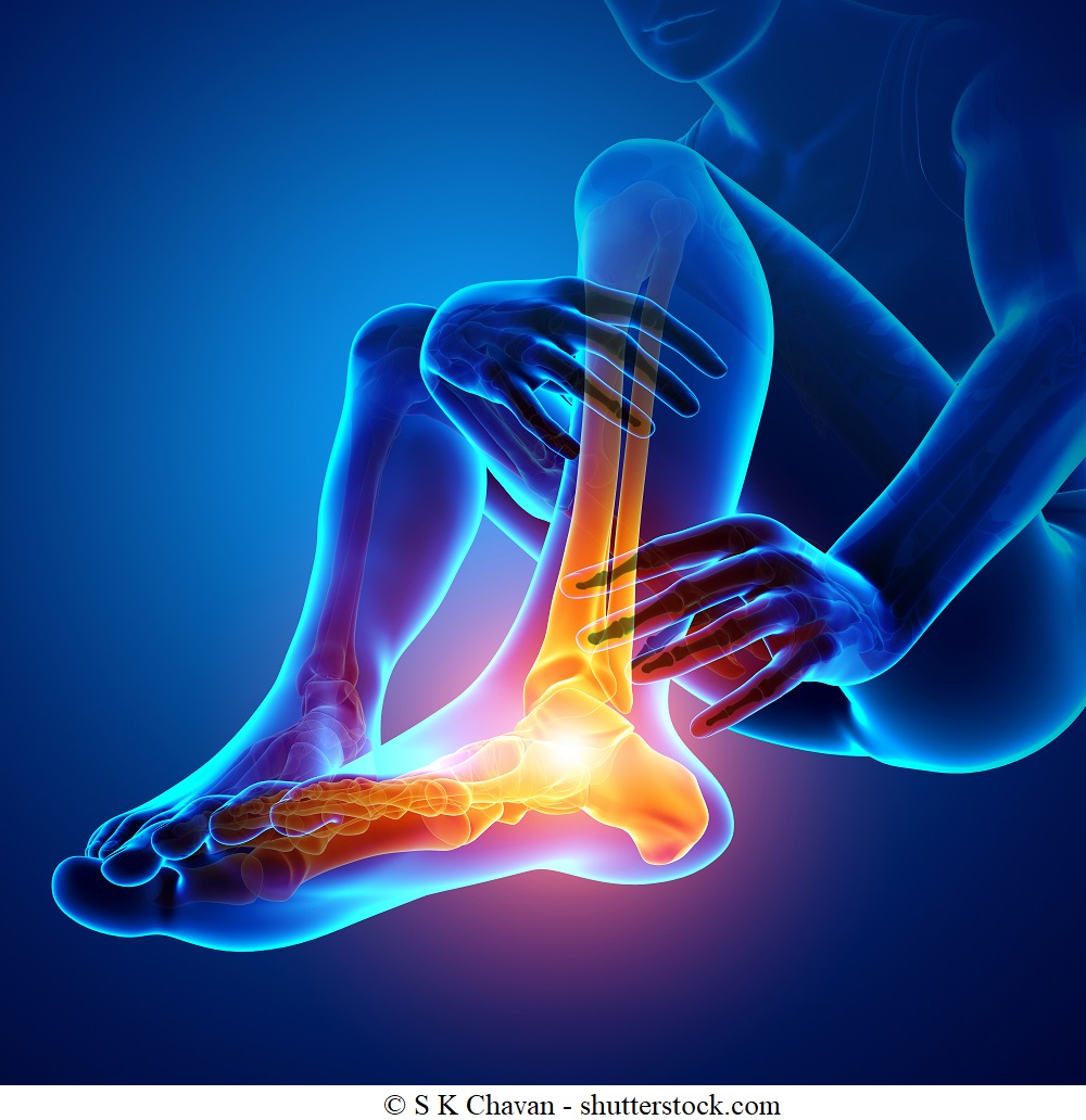 4 cause di dolore sotto al piede (o alla pianta)