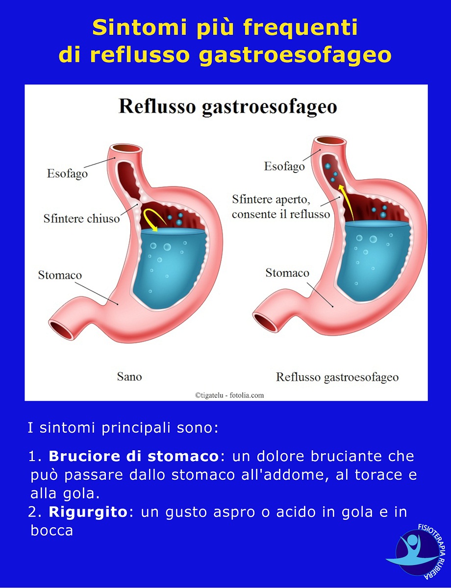 Sintomi-di-reflusso-gastroesofageo