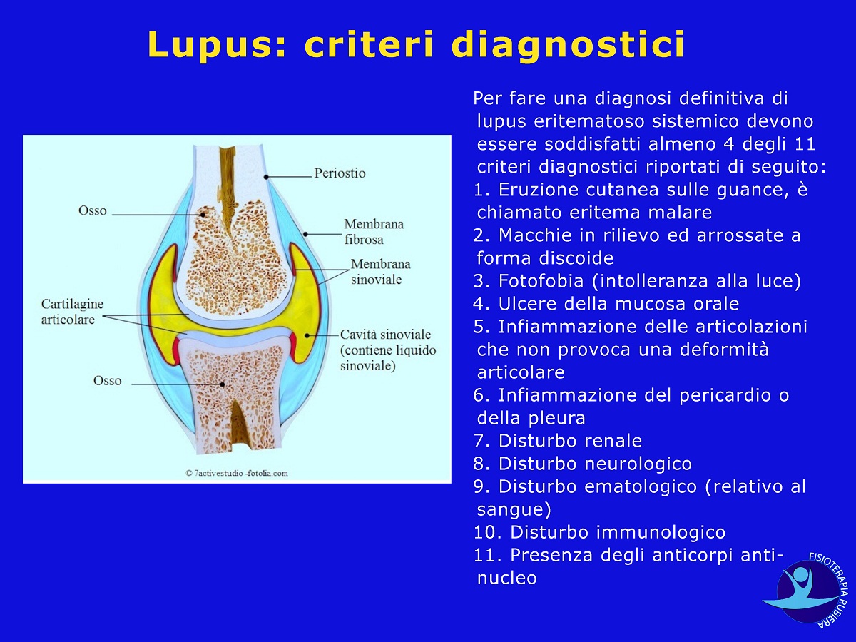 Lupus-criteri-diagnostici