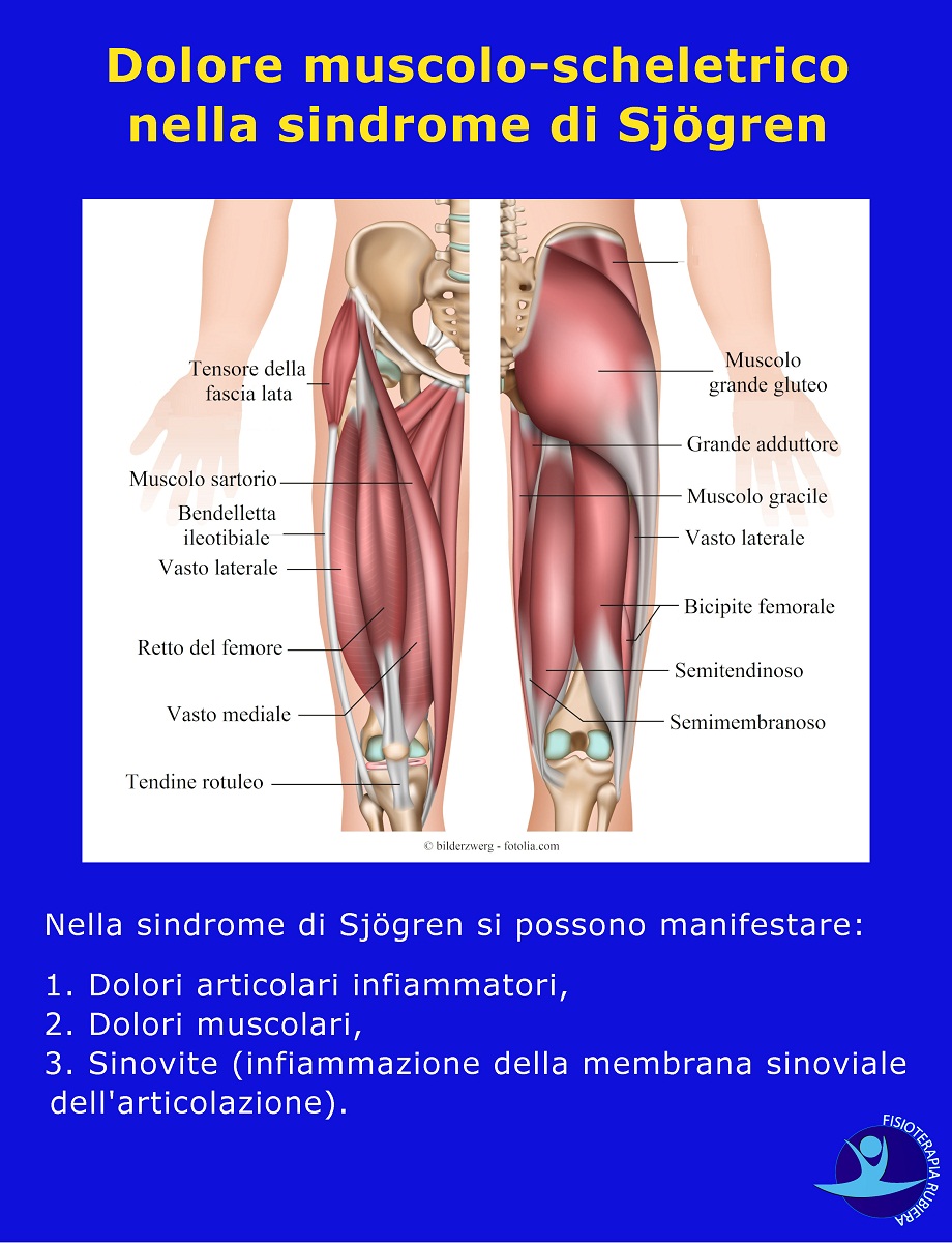 Dolore-muscolo-scheletrico-nella-sindrome-di-Sjögren