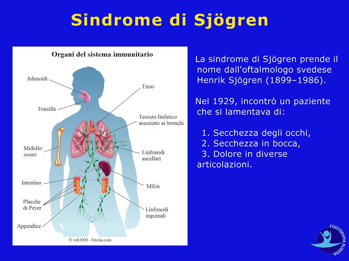 Sindrome-di-Sjögren