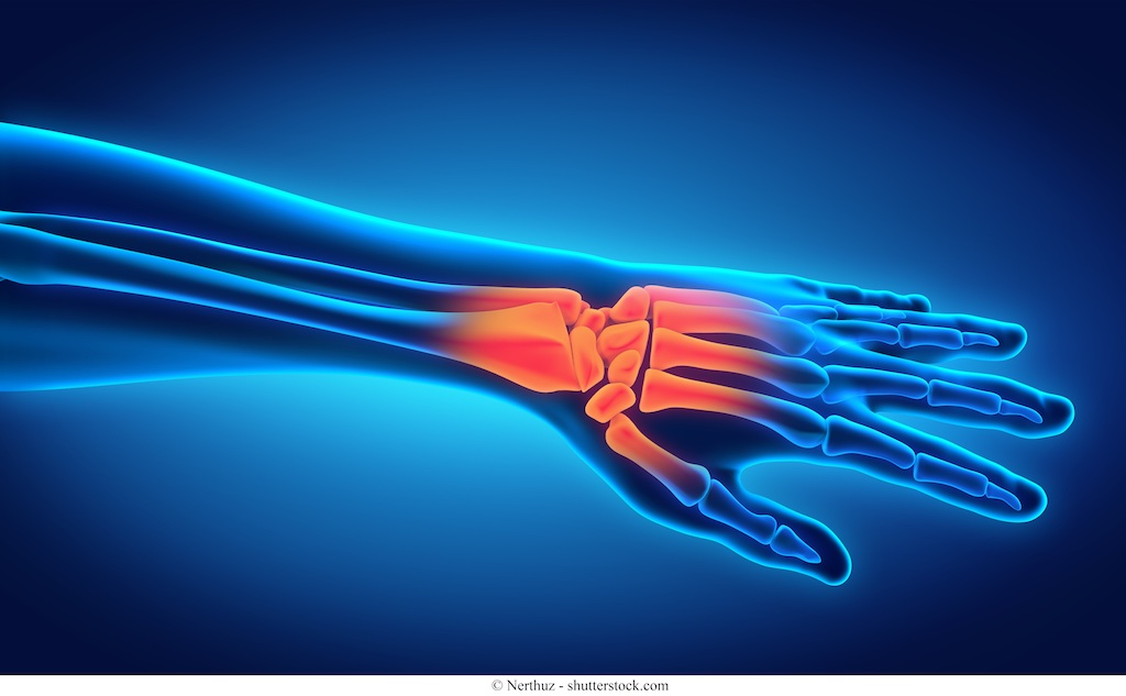 Artrosi del Pollice (Rizoartrosi): i Sintomi e la Terapia più Efficace