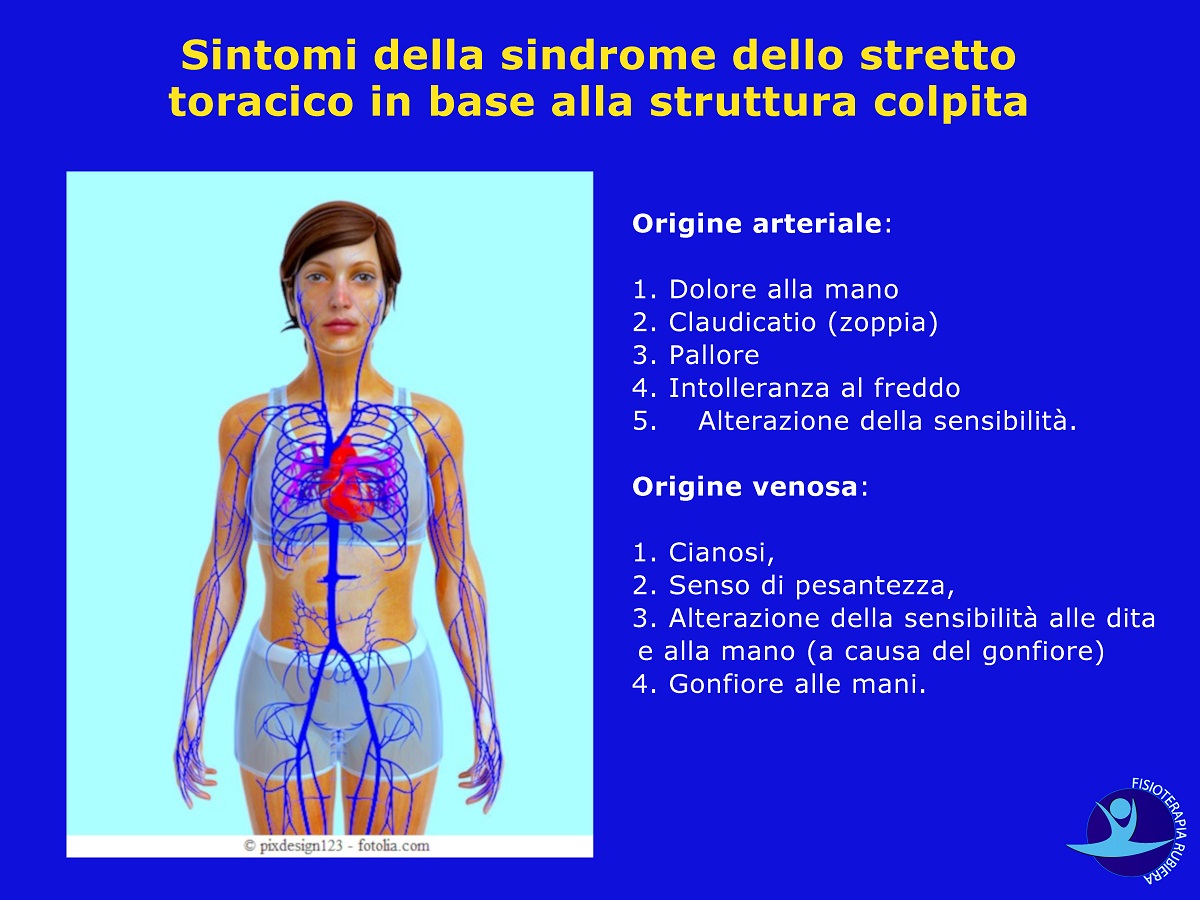 Sintomi della sindrome dello stretto toracico in base alla struttura colpita