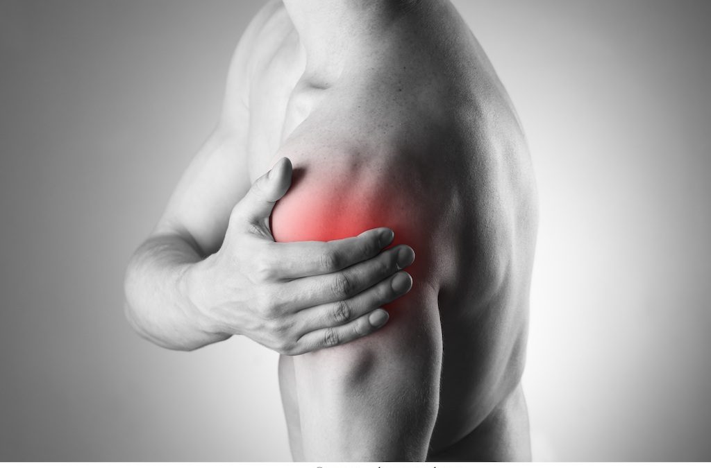 Instabilità della spalla o sublussazione – sintomi e fisioterapia