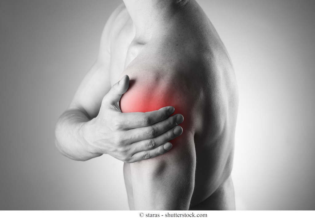 Instabilità della spalla o sublussazione - sintomi e intervento