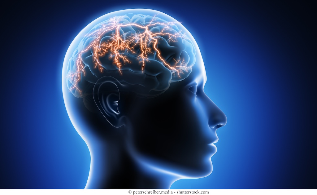 Ictus cerebrale ischemico o emorragico – riabilitazione e prevenzione
