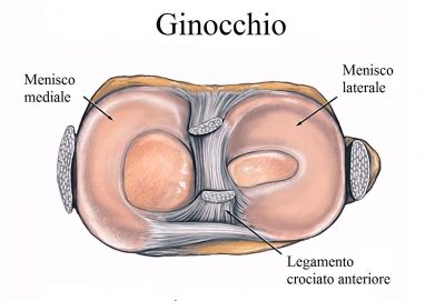 Anatomia del ginocchio,menisco,laterale,mediale