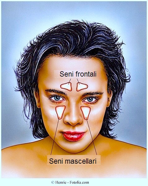 Sinusite,seni frontali,seni mascellari,nasali