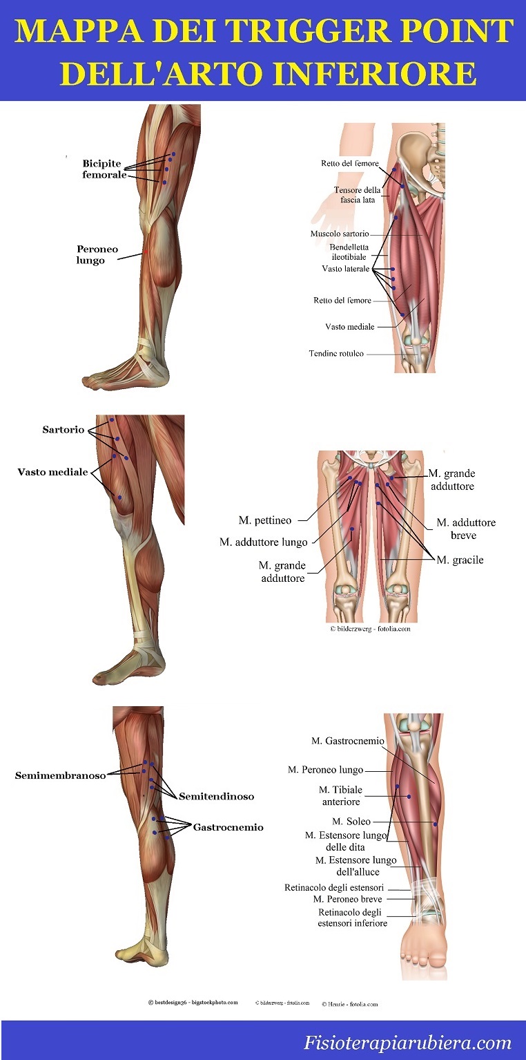 mappa trigger point, muscoli, gambe, coscia