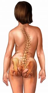 Scoliosi,destro convessa,colonna vertebrale