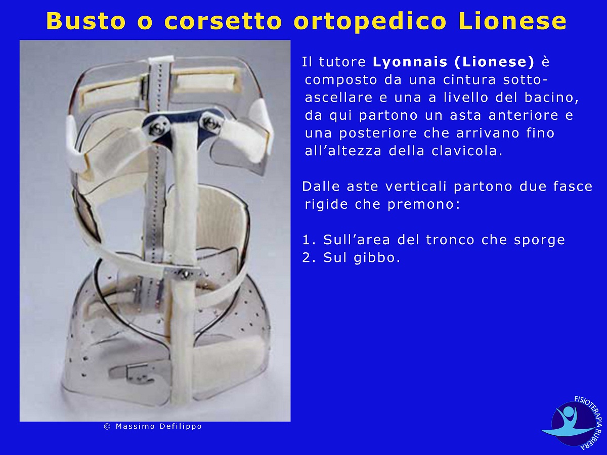 Busto-o-corsetto-ortopedico-Lionese