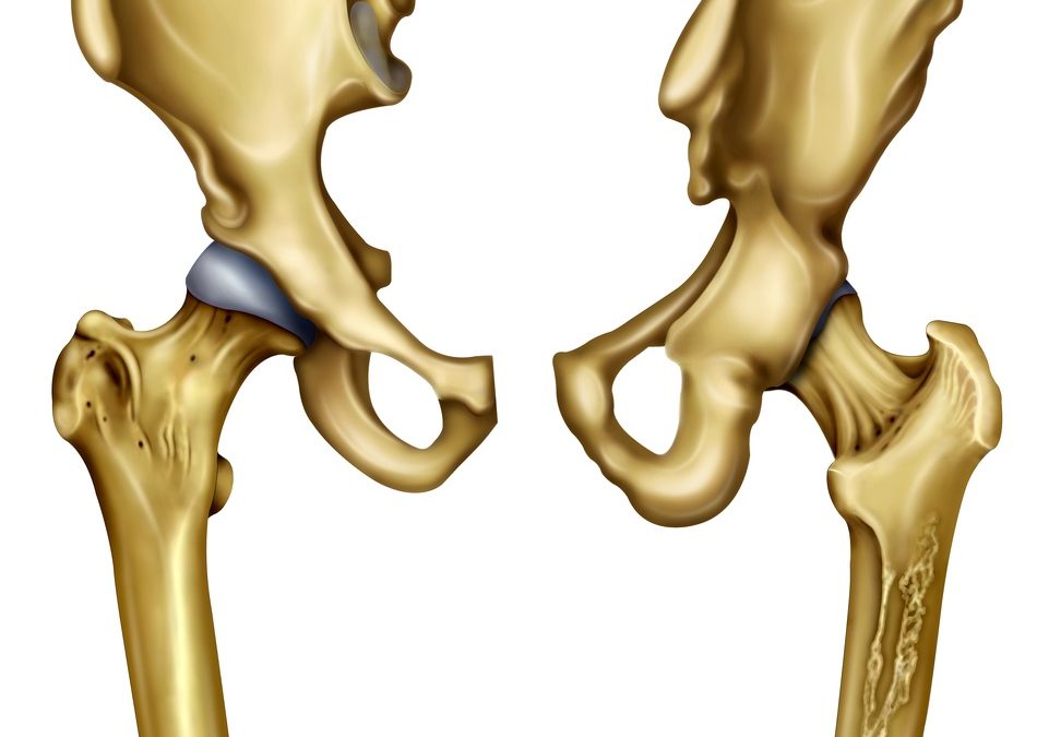 Anatomia dell’anca