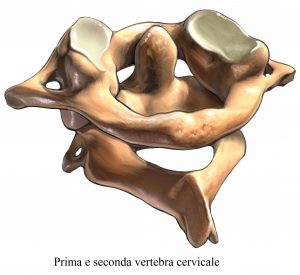 Cervicale alta,vertebre cervicali