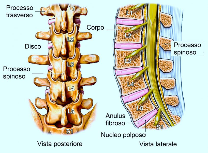Colonna vertebrale lombare,corpo,disco,nervo spinale,anulus fibroso,nucleo polposo