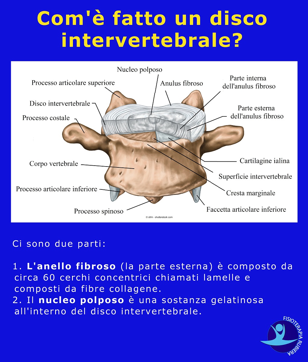 disco-intervertebrale