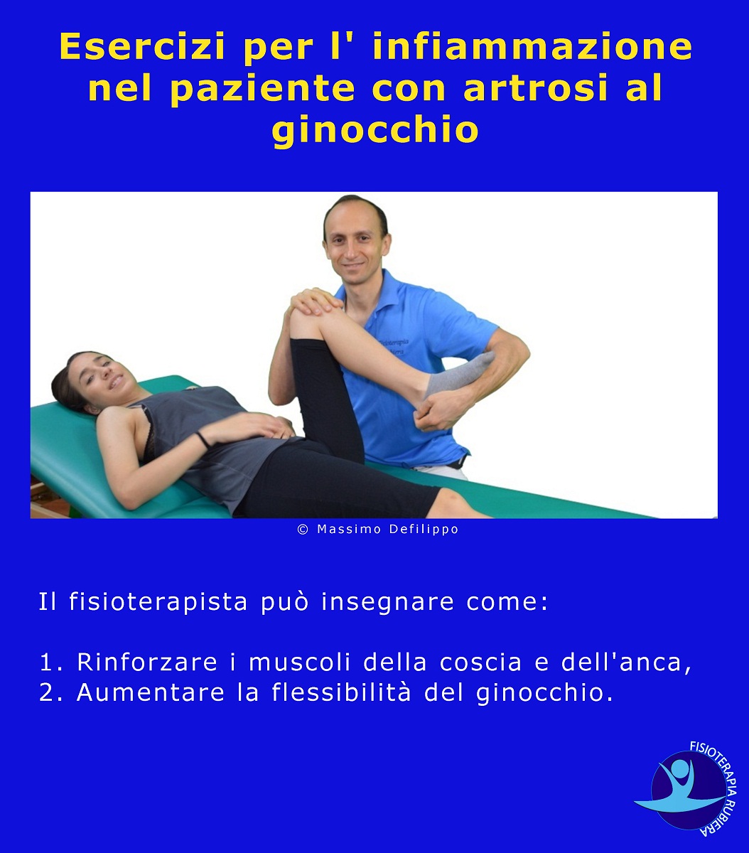 Esercizi per l' infiammazione nel paziente con artrosi al ginocchio