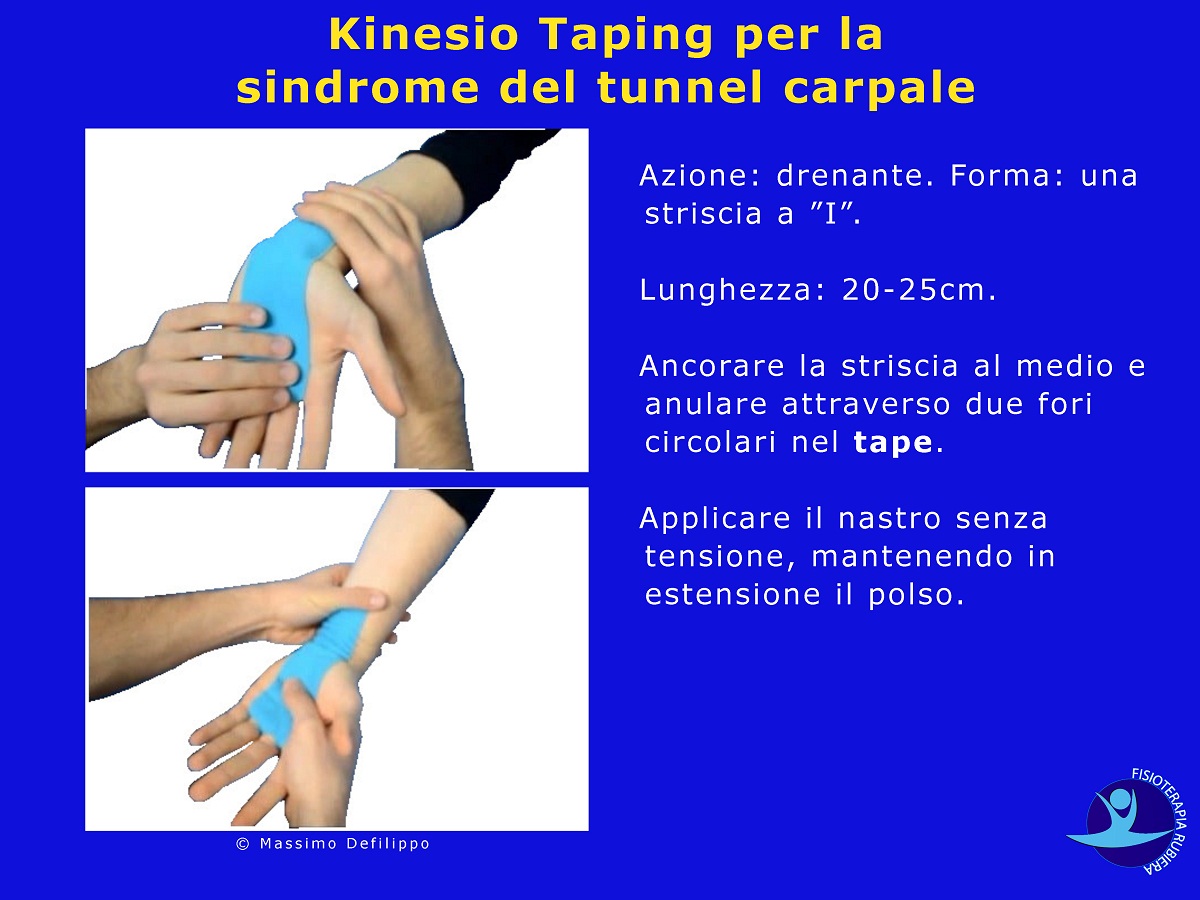 Kinesio Taping sindrome tunnel carpale